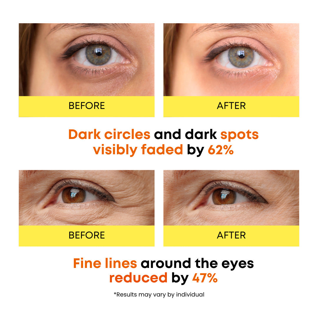 Vitamin C Eye Masks - Brightening Under-Eye Patches for Puffiness & Fine Lines