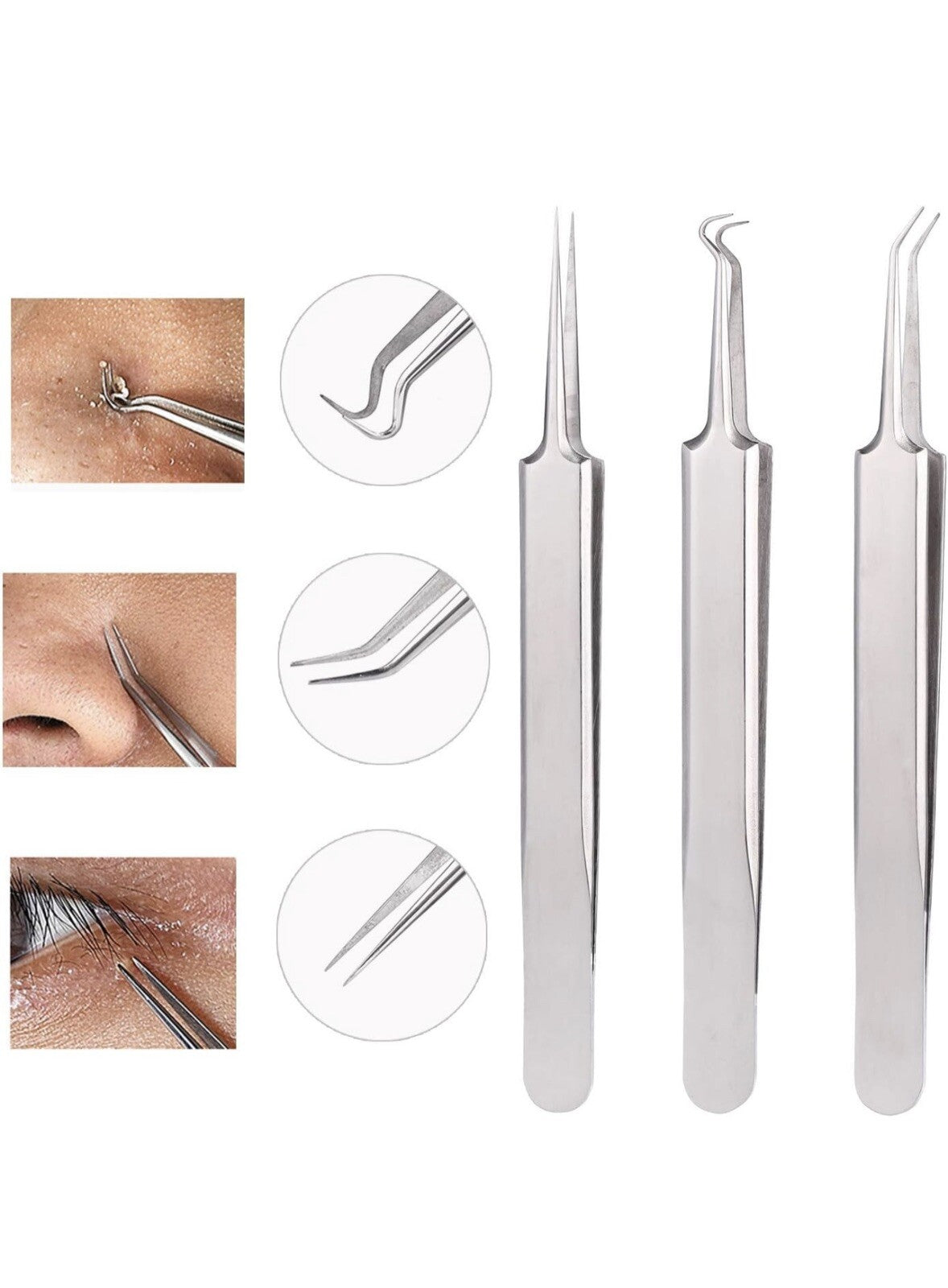 3-Piece Blackhead Remover Kit - Pimple & Acne Extraction Tools Set