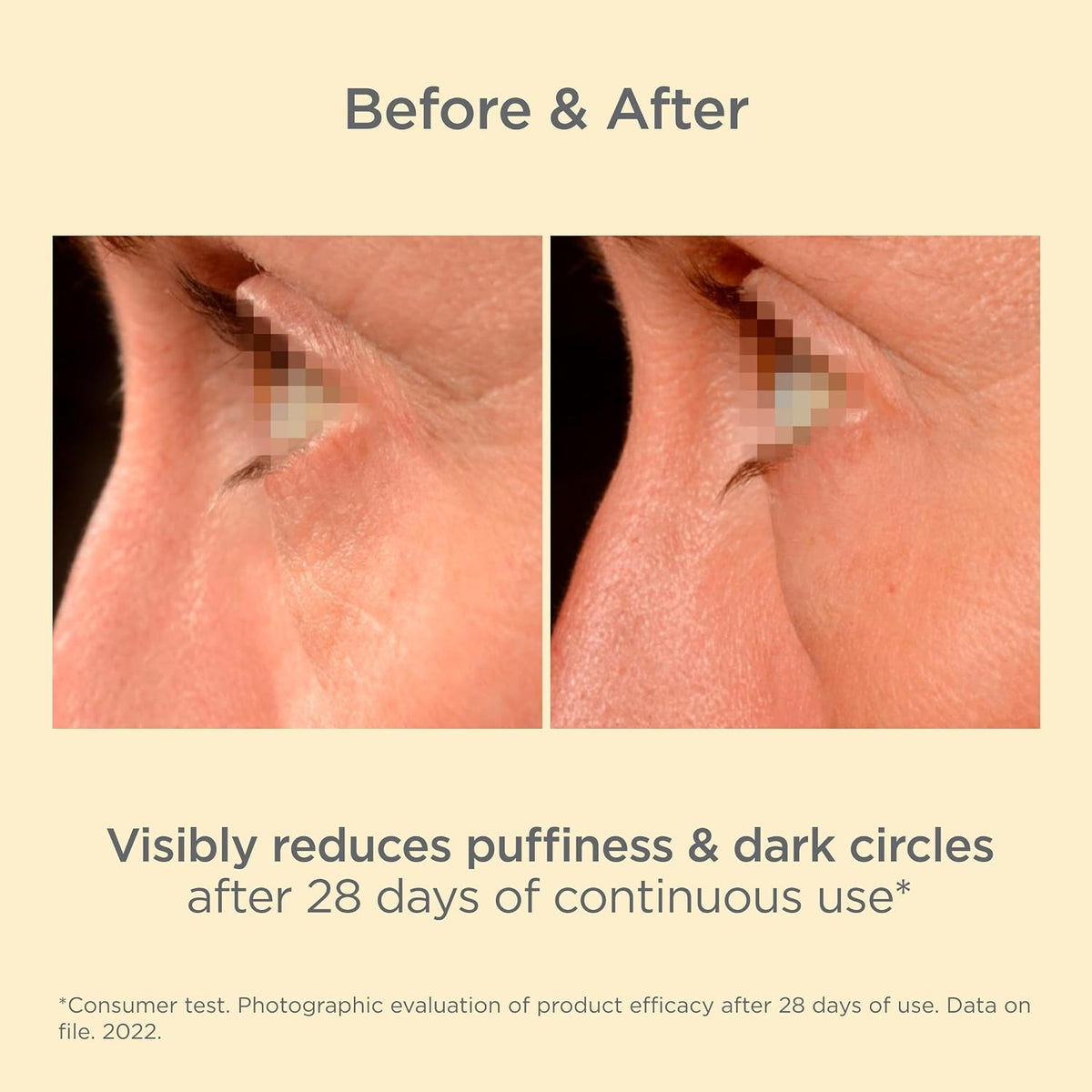 K-Ox Eyes Cream for Dark Circles Puffiness & Fine Lines - 15g