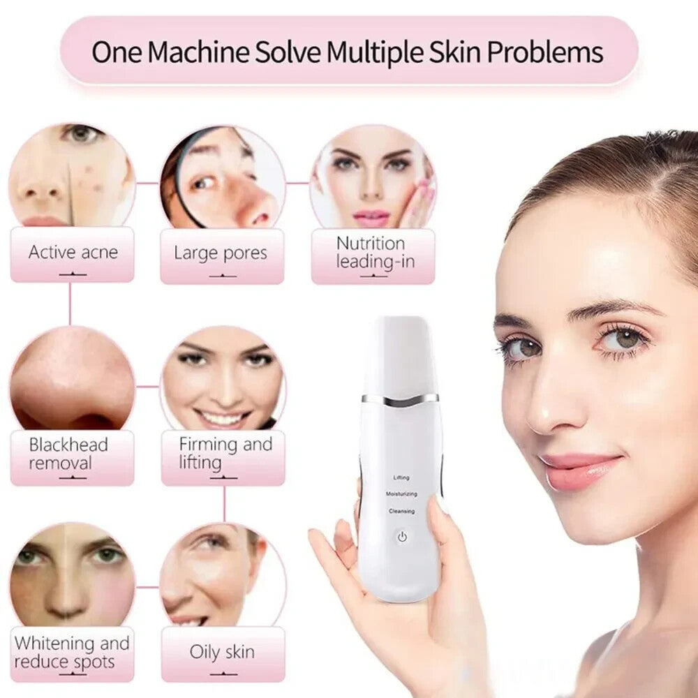Deep Vibrating Face Scrubber and Blackhead Remover - Skin Cleansing Tool