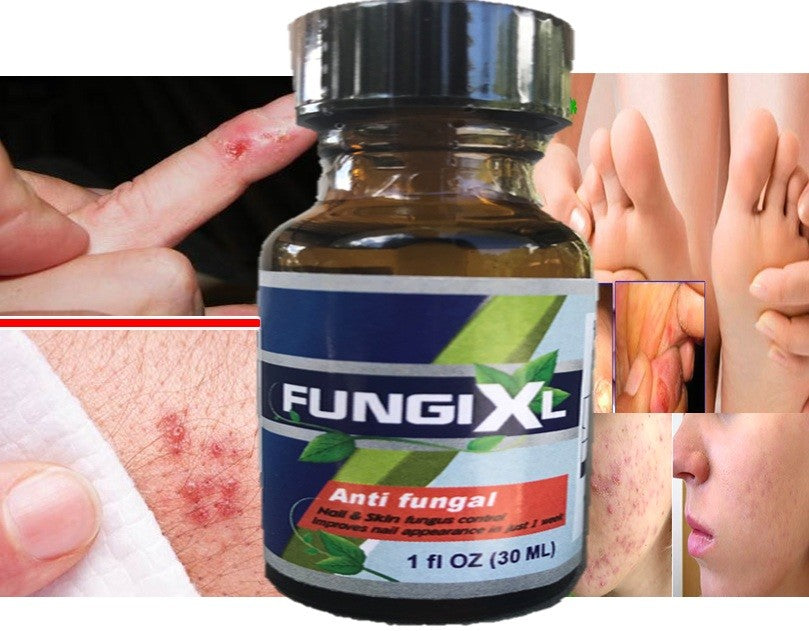 Antifungal Salicylic Acid Gel for Feet, Nails & Hands