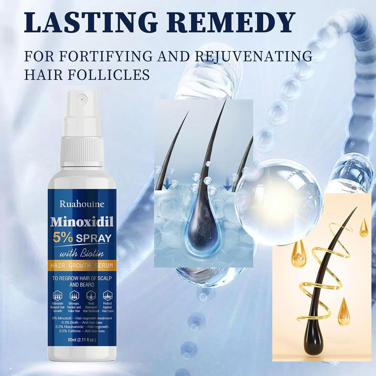 Hair Regrowth Treatment Spray with 5% Minoxidil – Strengthens &