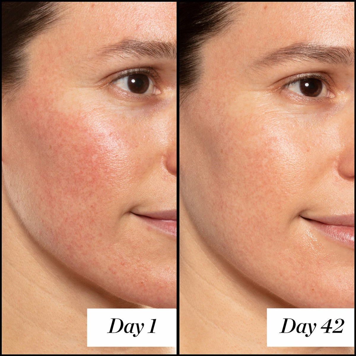 Retinol Serum Moisturizer with Hyaluronic Acid