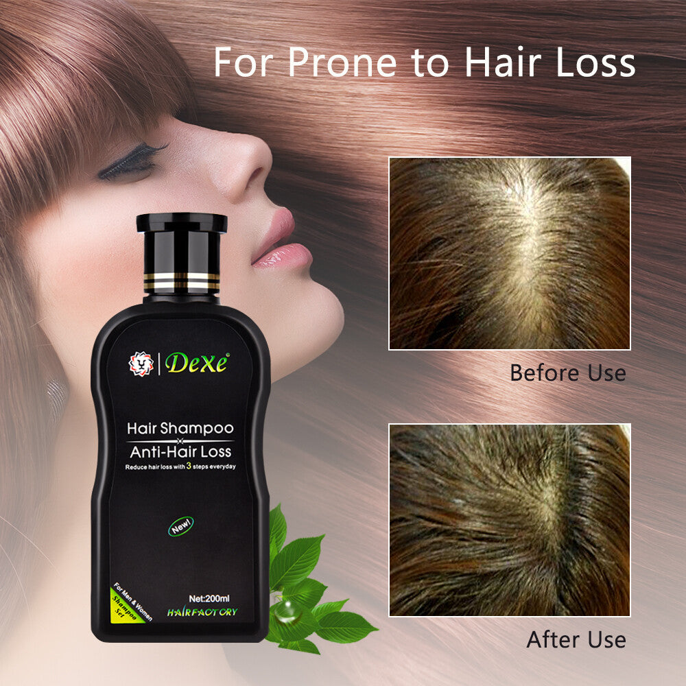 Anti-Hair Loss Shampoo for Men & Women - 200ml