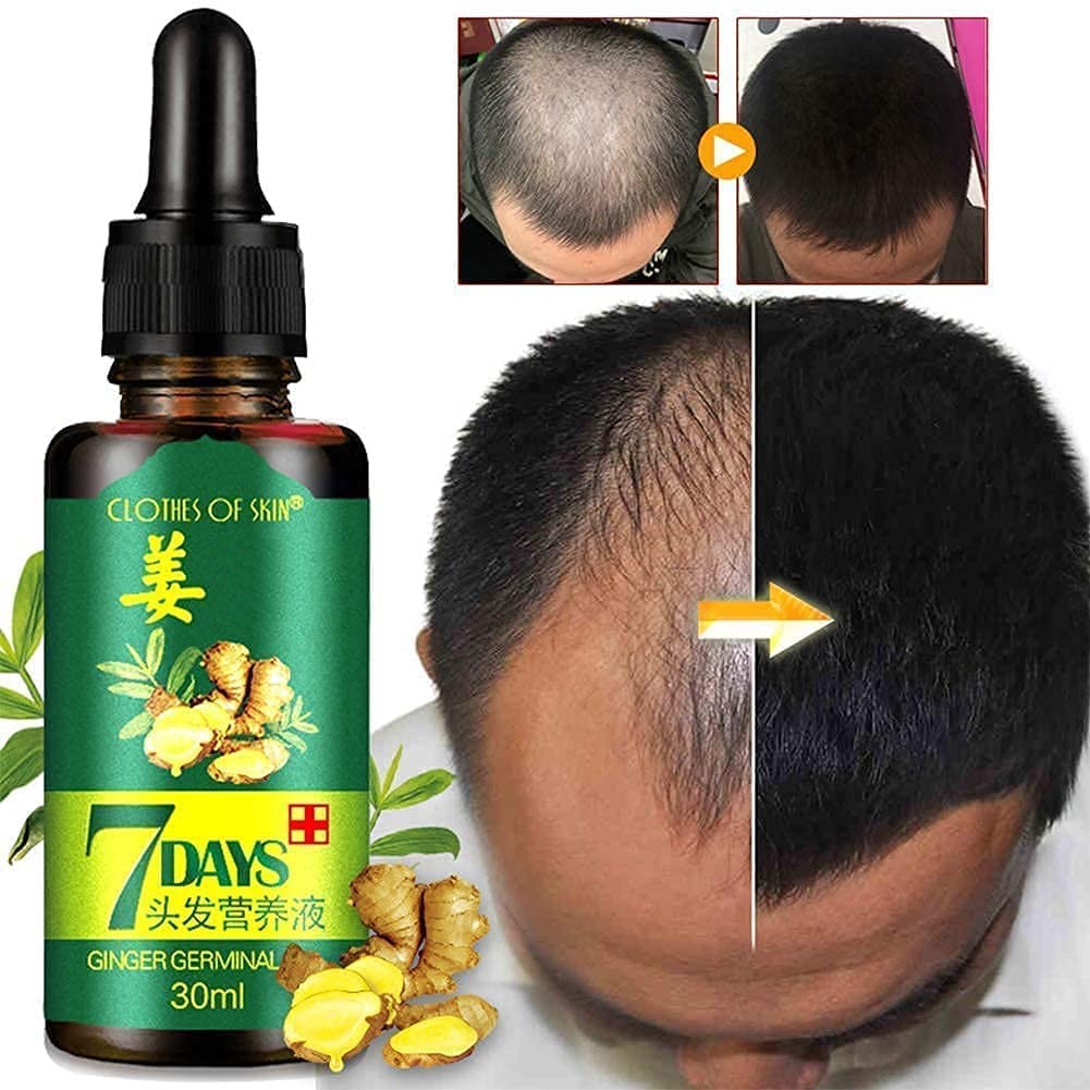 Hair Regrow 7 Day, Ginger Germinal Essential Oil 1 Fl Oz (Pack of 1),
