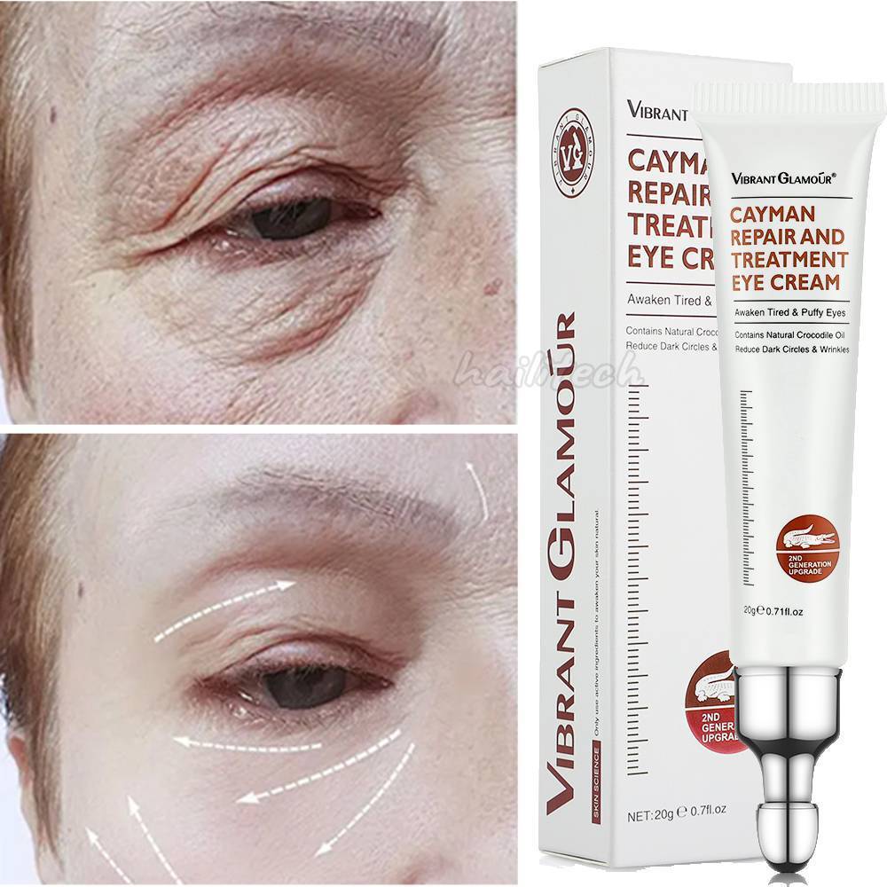 Collagen Retinol Eye Cream for Dark Circles & Wrinkles - 20g
