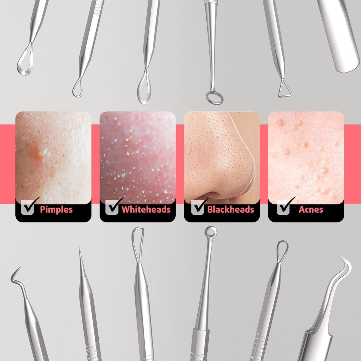 6-Piece Stainless Steel Blackhead Remover Kit - Ergonomic & Durable