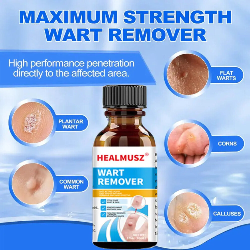 Wart Remover Liquid for Common and Plantar Warts - Natural Herbal Formula