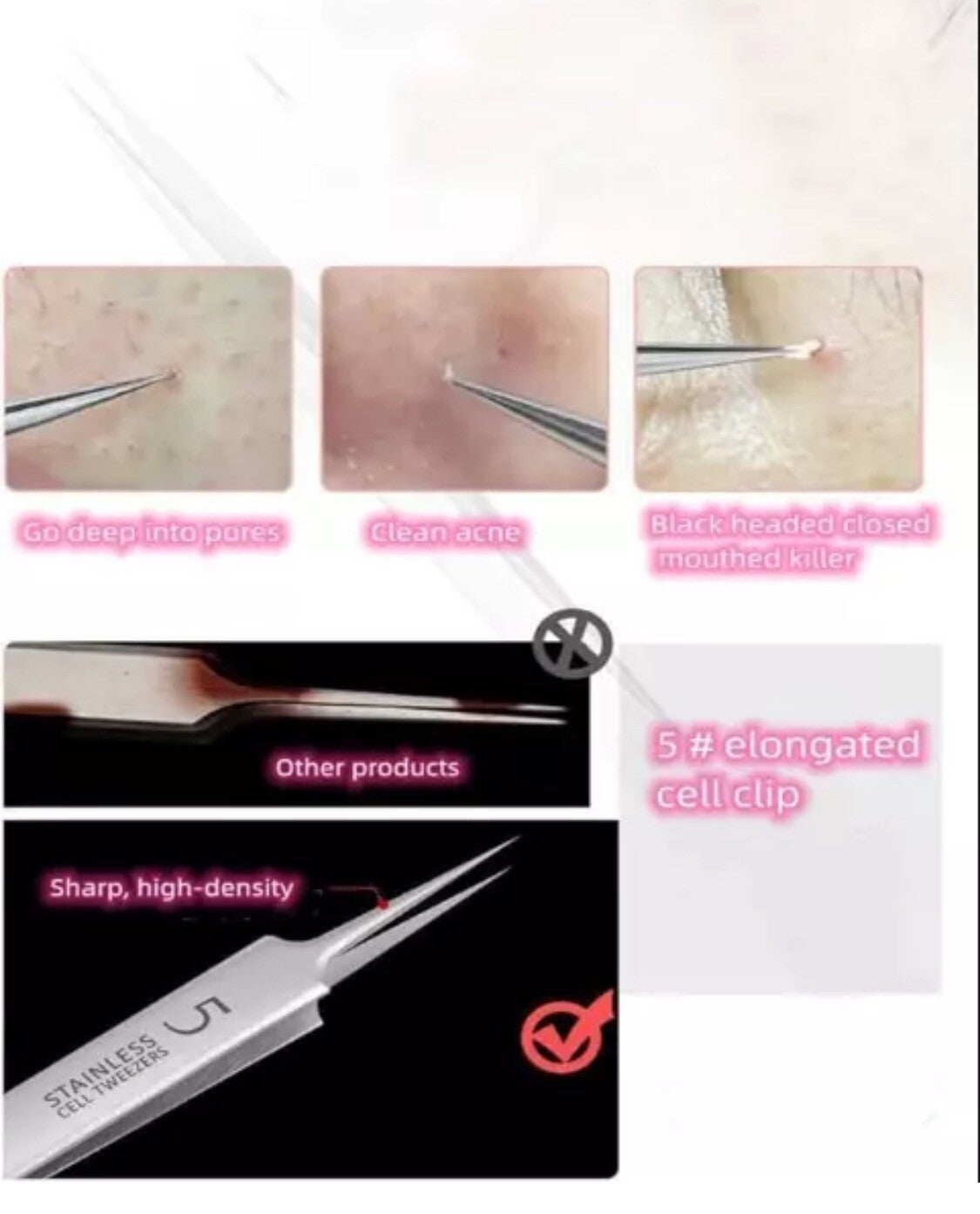 Professional Blackhead Removal Tweezers Acne Pimple Extractor Kit