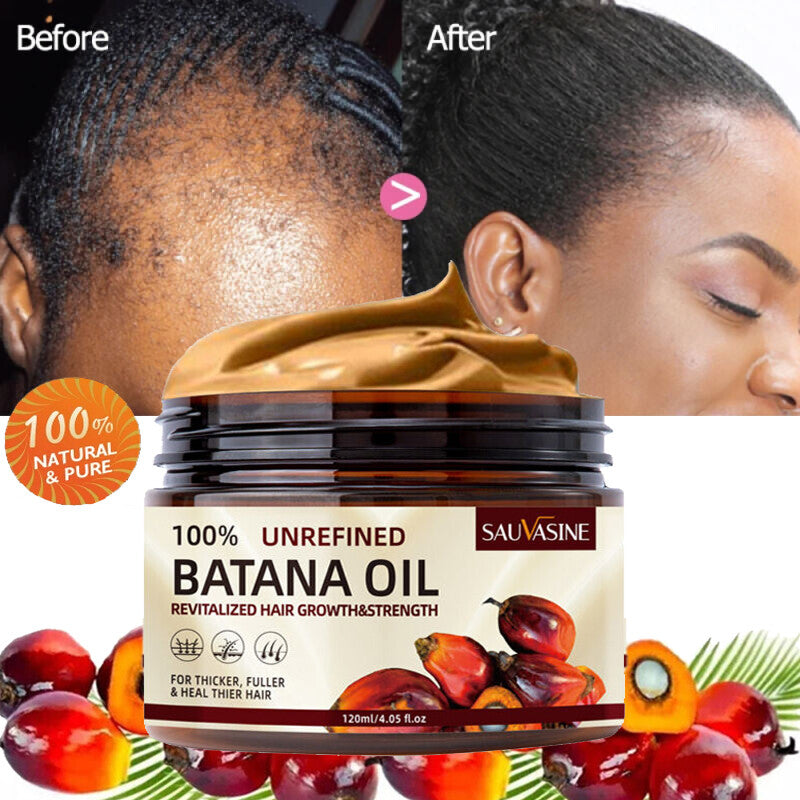 Hair Growth Treatment - 120ml Conditioner