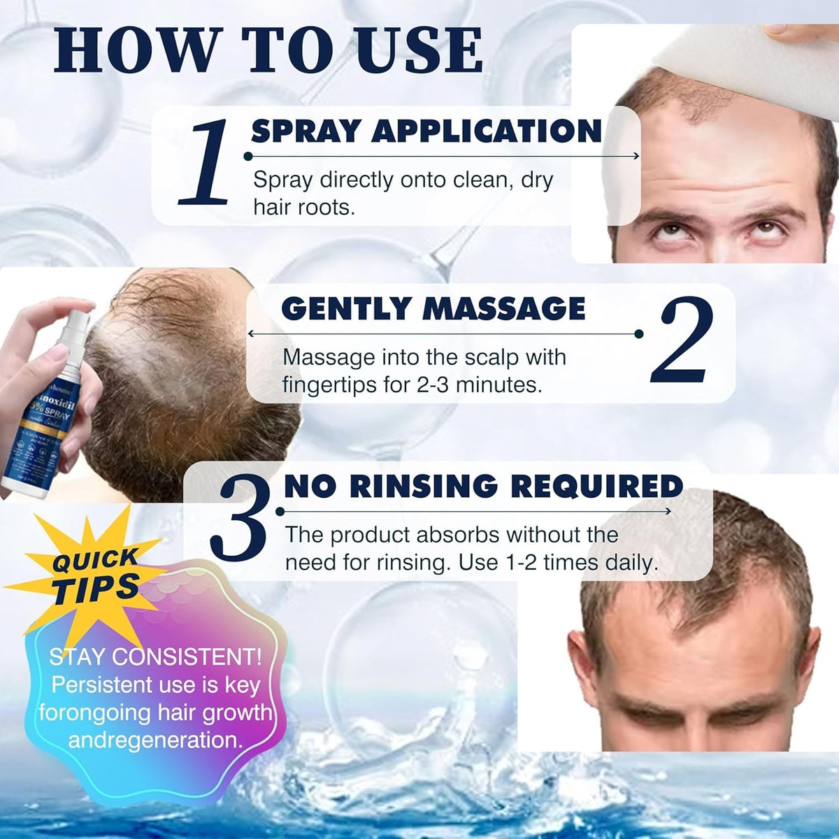 Hair Regrowth Treatment Spray with 5% Minoxidil – Strengthens &