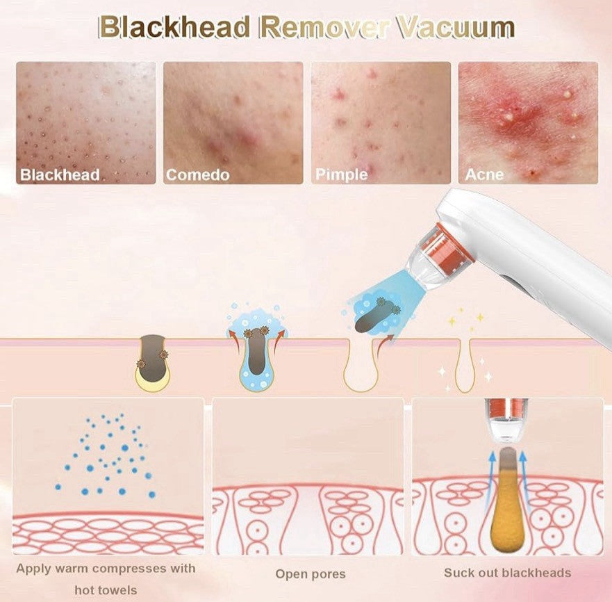 Blackhead Remover Vacuum with HD Camera & App, Rechargeable, 4 Probes