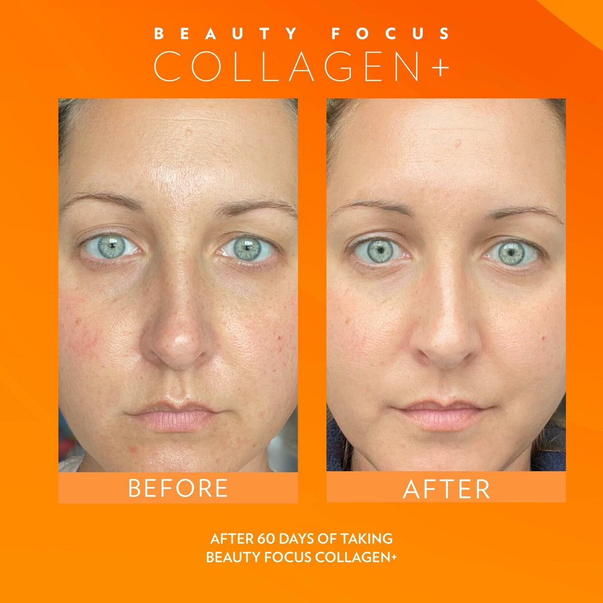 Liquid Collagen Drink for Skin Radiance and Anti-Aging - Peach Flavor, 30 Days Supply