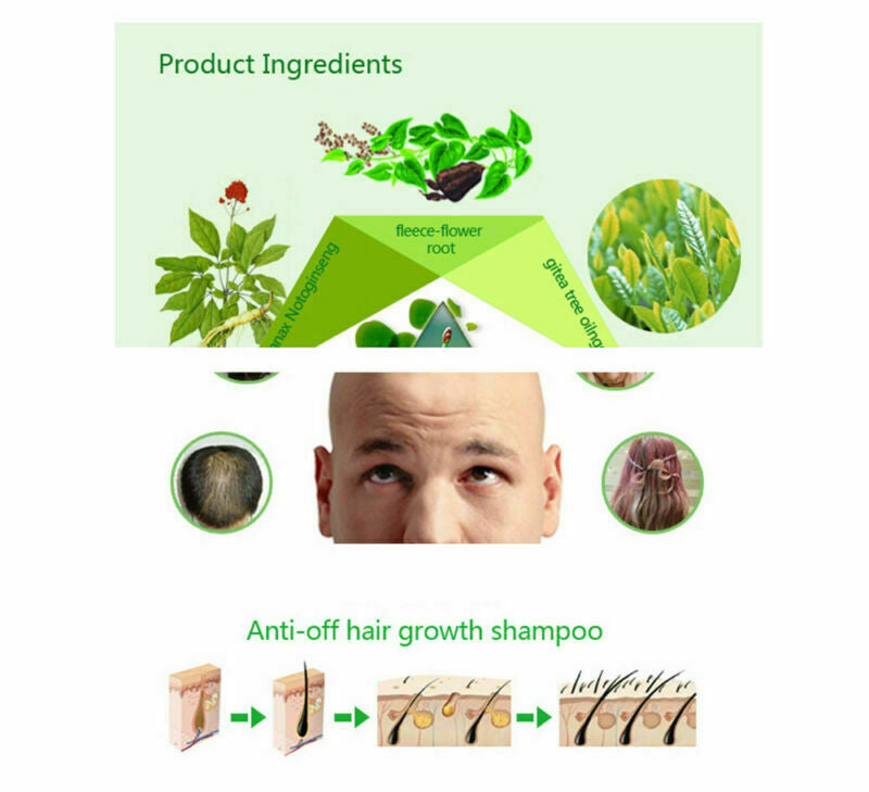 DEXE 200ml Anti-Hair Loss Shampoo Promote Hair Growth for Men & Women