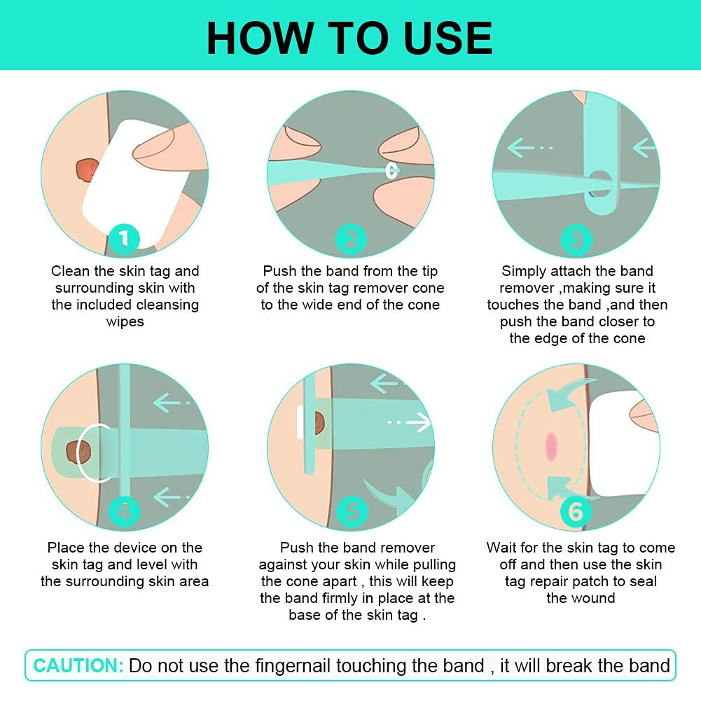 Skin Tag Remover Kit - Painless Wart & Acne Skin Tag Removal Device Set