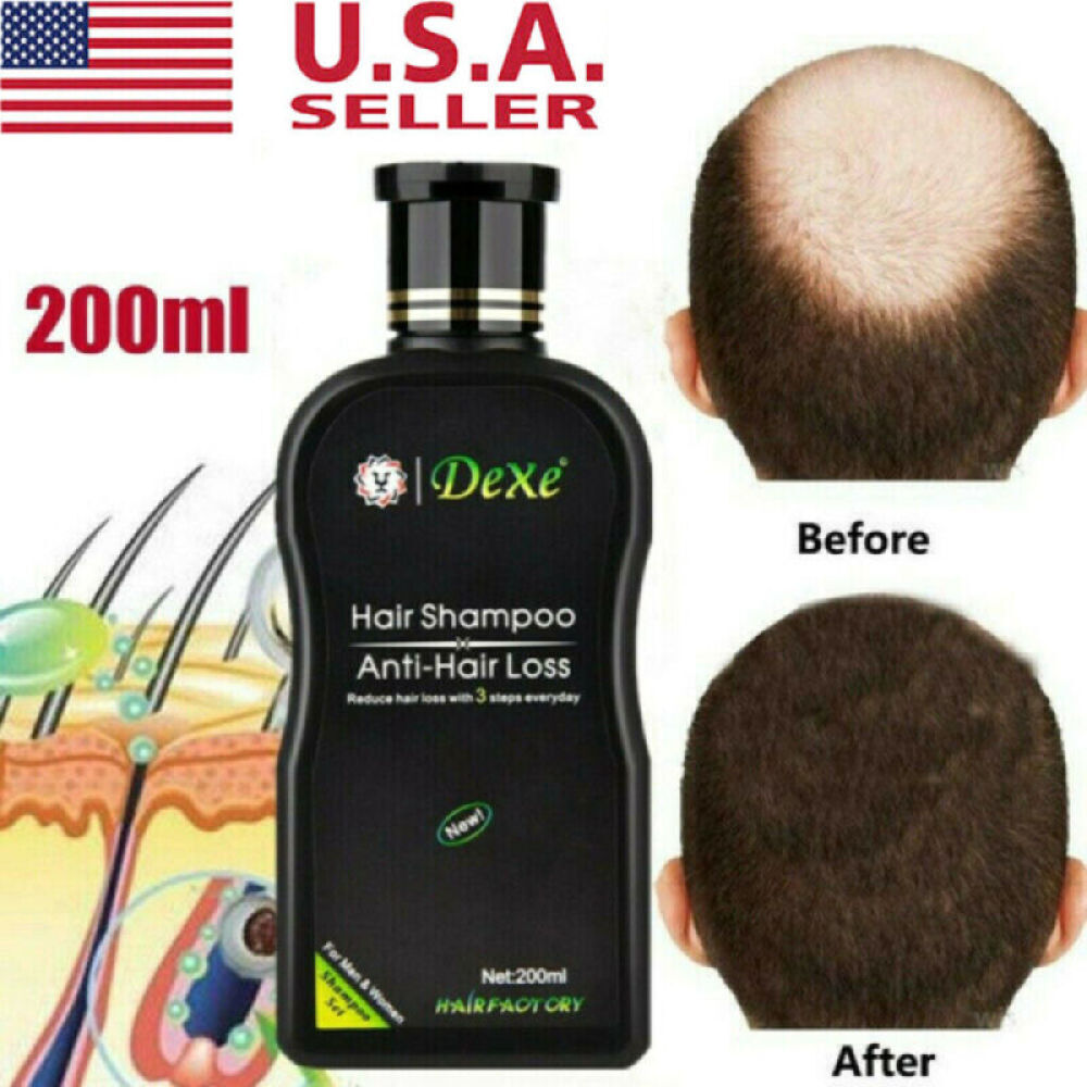 Anti Hair Loss Shampoo - 3Pc Set, 200ml Bottles