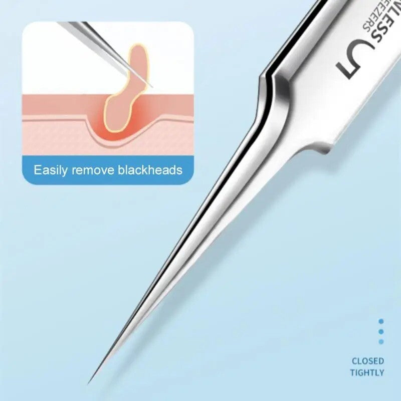Blackhead Remover Tweezers 3-Piece Acne Pimple Blemish Extractor Set