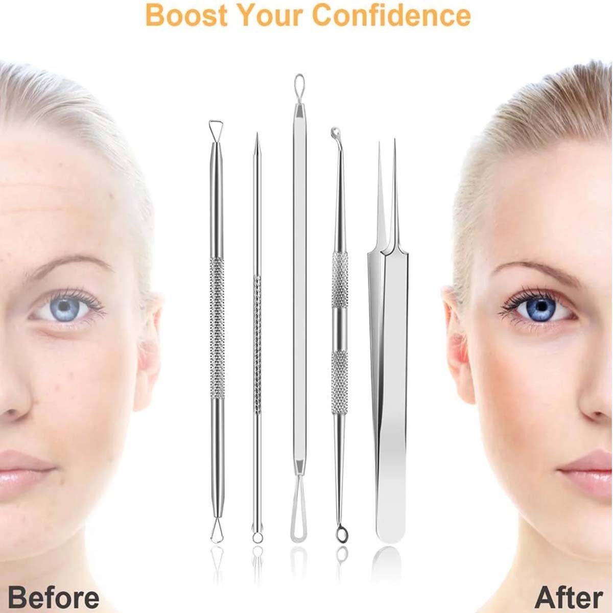 9-Piece Blackhead Remover Tool Kit for Comedone Extraction - Stainless Steel
