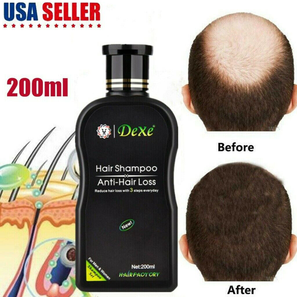 Anti-Hair Loss Shampoo for Men & Women, 200ml