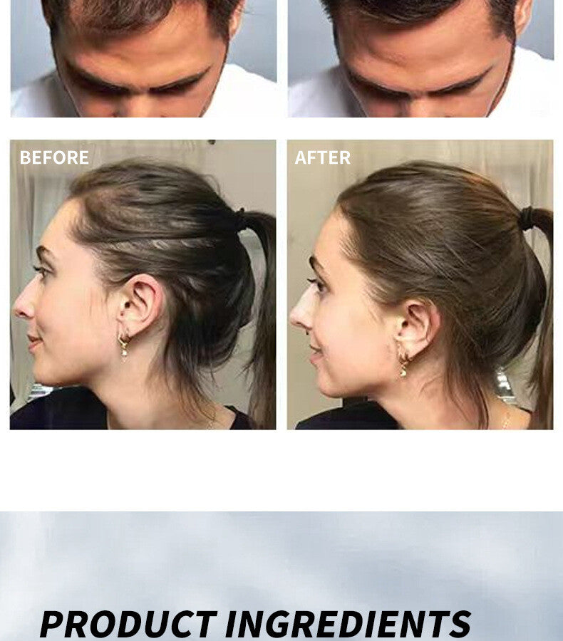 Hair Fiber Hair Loss Concealer Thickening Fibers Black 27.5g