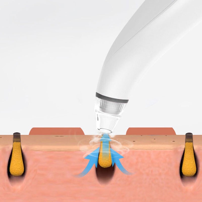 Electric Blackhead Remover Vacuum Facial Pore Cleaner with Adjustable Suction