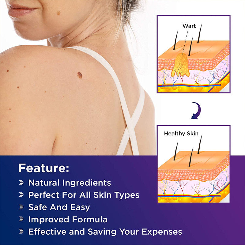 Skin Tag & Wart Remover Pen - Painless Natural Herbal Solution, 5ML, 2 Pack