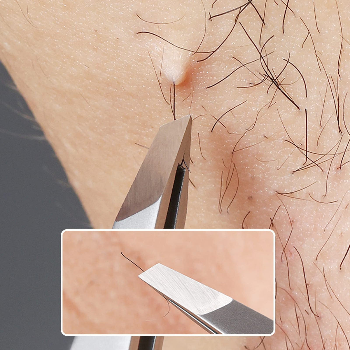 Eyebrow Hair Removal Tweezers Slant Tip 2 Pack for Precision Shaping