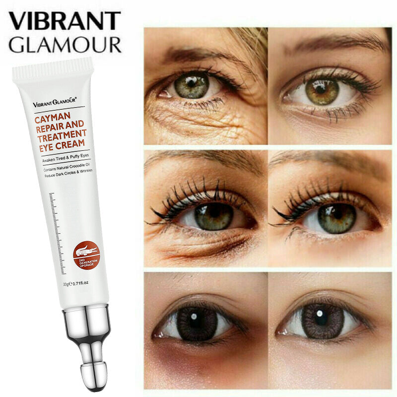 Under Eye Cream for Dark Circles Wrinkles Puffy Eyes - Hydrating & Anti-Aging