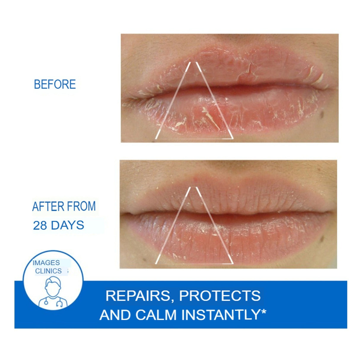 Lip Balm for Dry Lips Repairing Balm 15ml Water-Resistant Nourishing