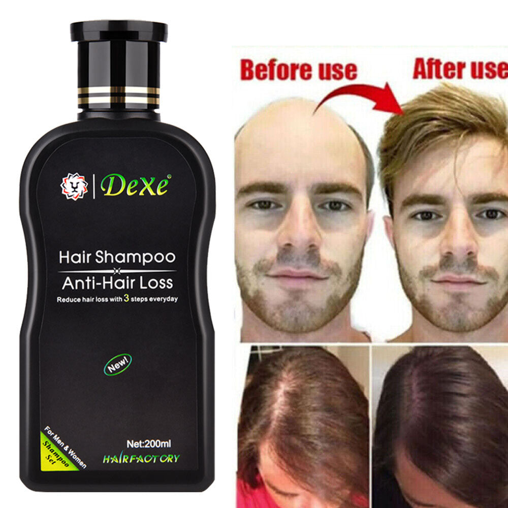 Anti-Hair Loss Shampoo for Men & Women, 200ml