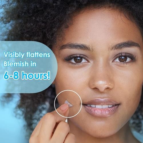 SeaShell Hydrocolloid Acne Pimple Patches - 120 Spot Stickers for Face