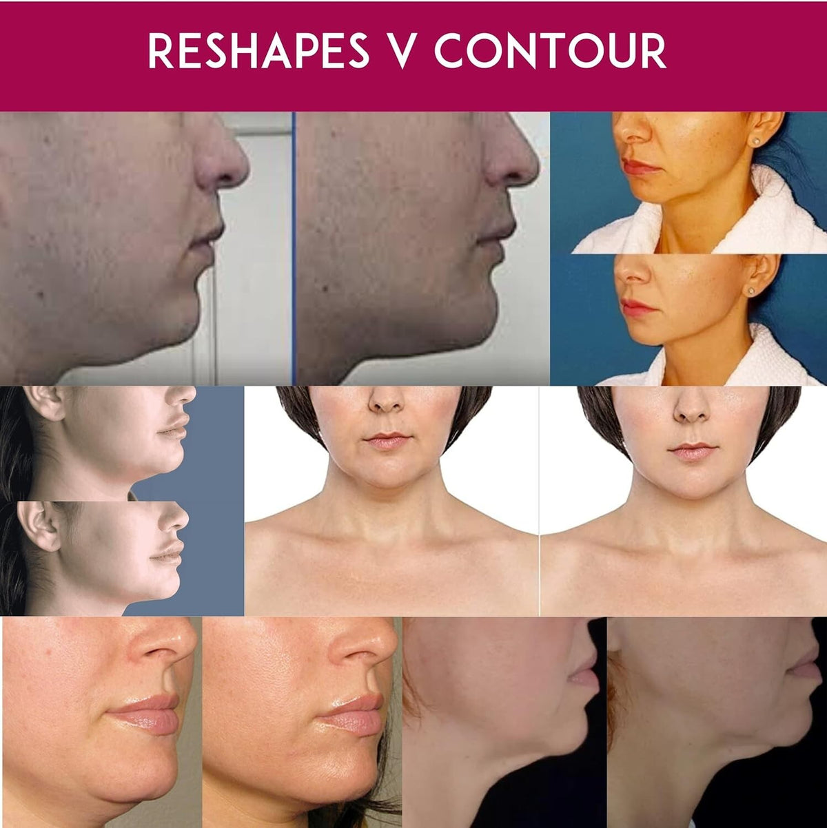 Anti-Wrinkle Face Shape Lift Mask & Chin Reducer Belt Set for Slimming & Contouring