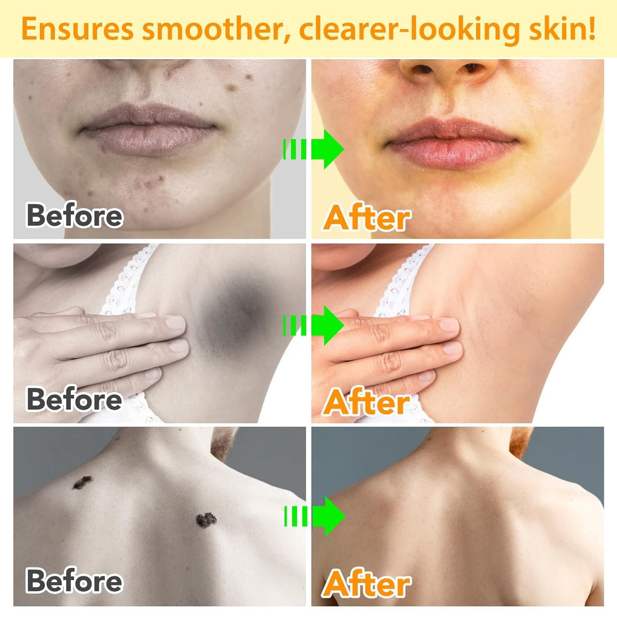 Bee Venom Skin Repair Cream for Anti-Aging & Scar Reduction 100g