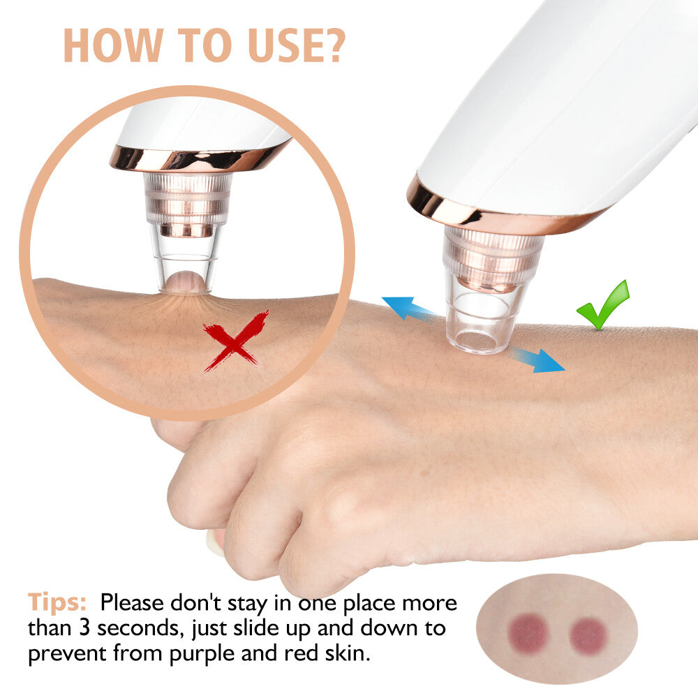 Electric Blackhead Vacuum Pore Cleaner Kit - USB Rechargeable Facial Tool