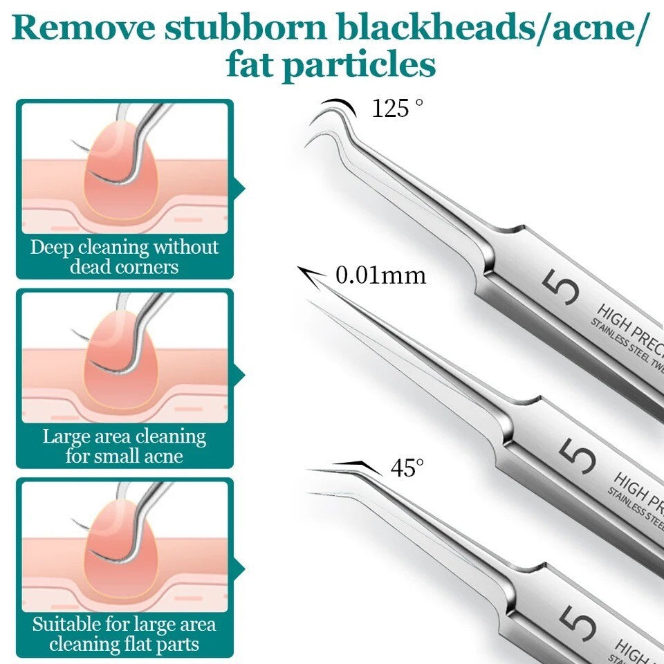 3PC Ultra-Fine Blackhead Remover Tweezer Set for Face Care - Salon Quality