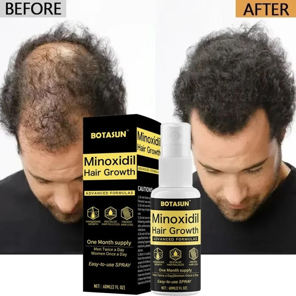 5% Minoxidil Hair Regrowth Spray Serum