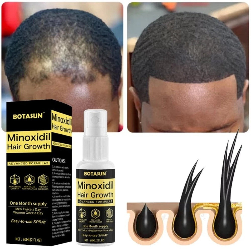 5% Minoxidil Hair Growth Serum Spray