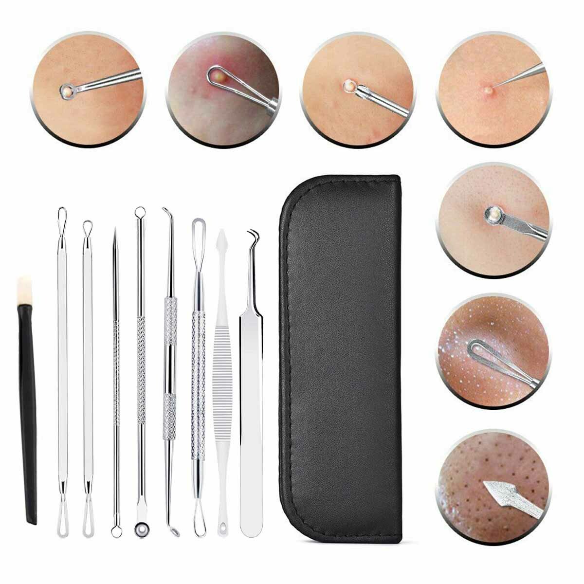 Blackhead Remover Tool Kit - 9 Pcs Acne & Comedone Extraction Set