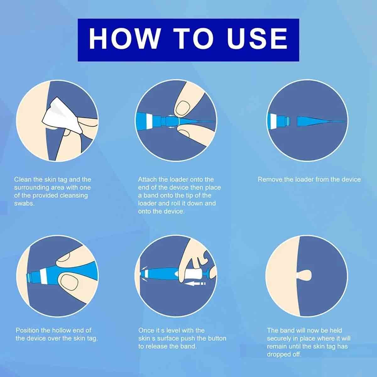 Painless Skin Tag Remover Pen Kit - 2-in-1 Wart & Mole Removal Tool