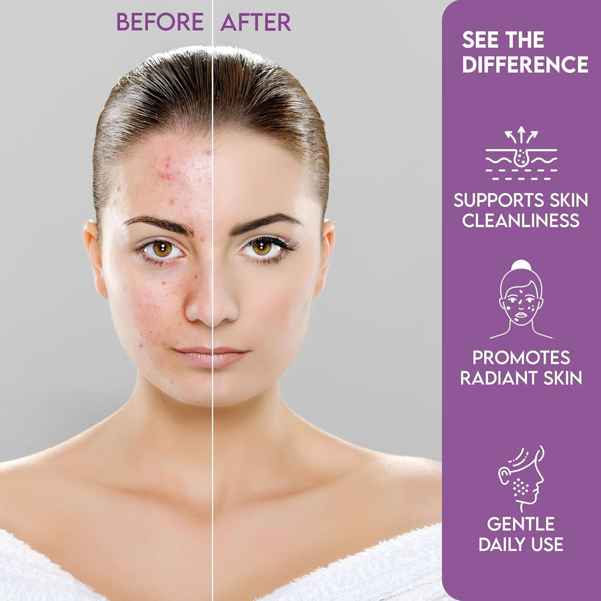Full Face Hydrocolloid Acne Patches - Large Zit Stickers for All Skin Types