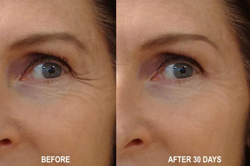 Peptide Face Serum with Argireline Hyaluronic Acid Matrixyl 3000 Anti-Aging Moisturizer