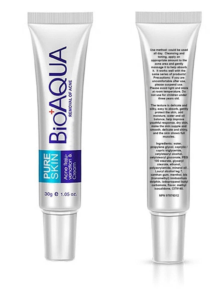 Acne Treatment Cream for Blemishes & Spots - 30ml Face Skin Care