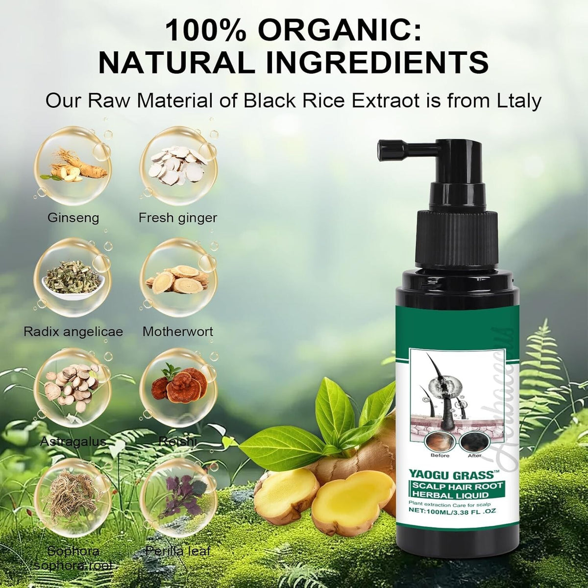 Scalp Treatment Serum for Hair Growth & Anti-Dandruff Relief