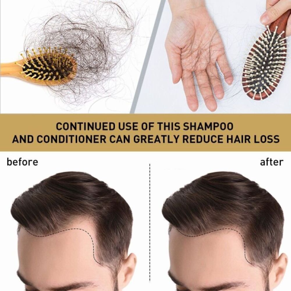 DEXE Anti-Hair Loss Shampoo Chinese Herbal Hair Regrowth Growth For