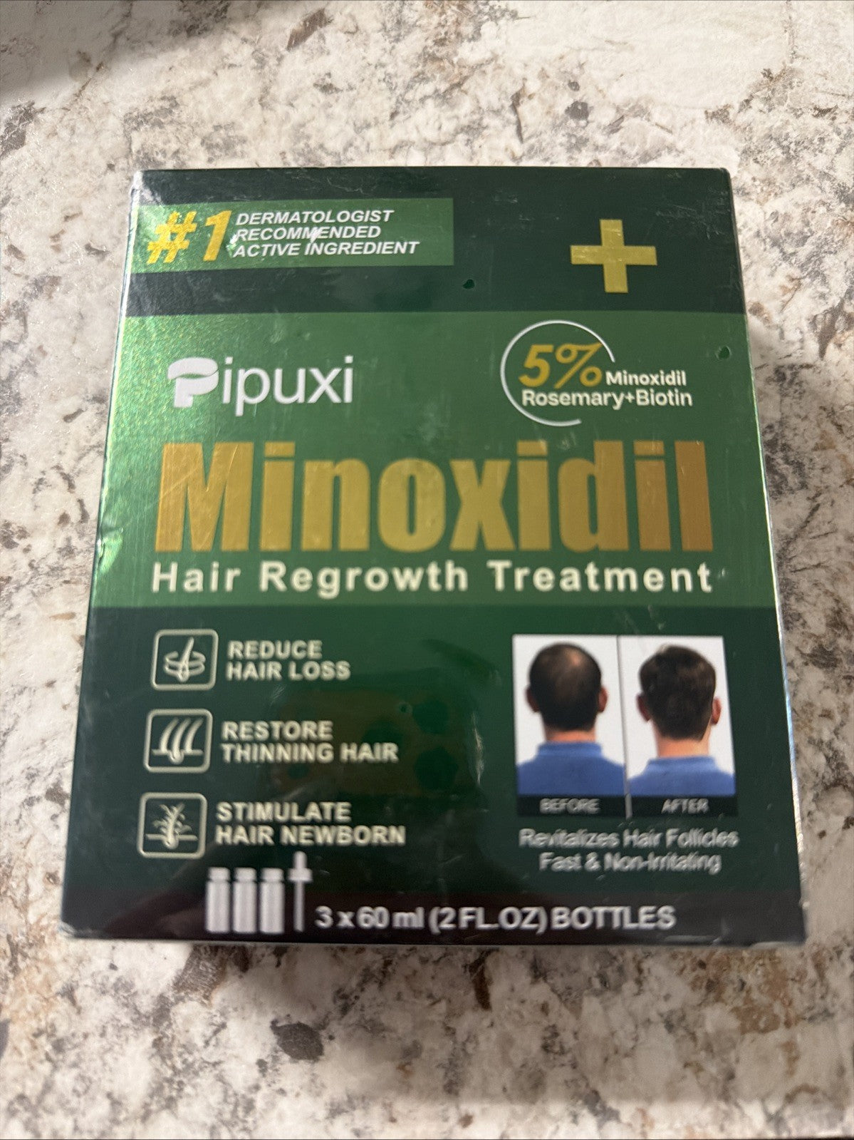 Minoxidil 5% Hair Regrowth Treatment with Rosemary & Biotin, 3 x 60ml