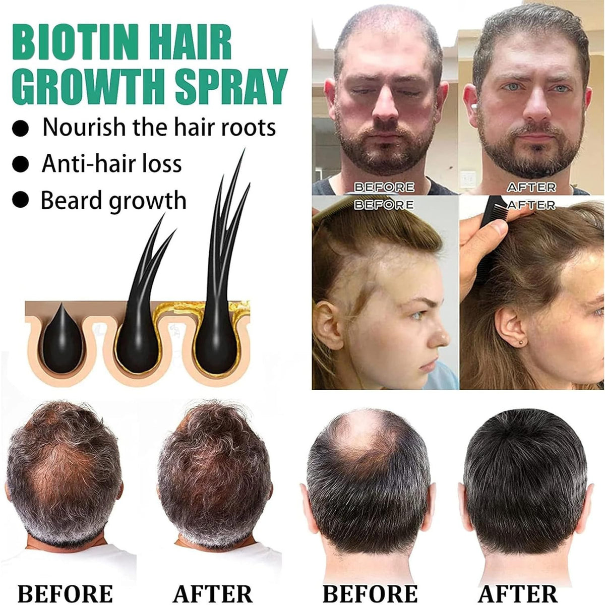 Biotin Hair Growth Serum, Spray, Ginseng Root Extract, Ginger