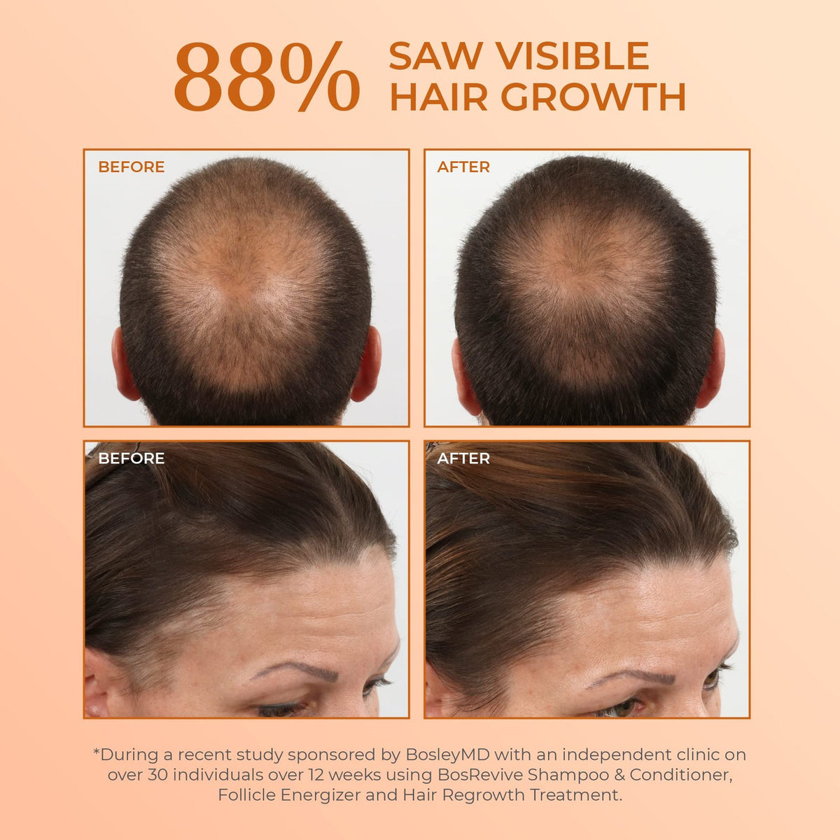 Volumizing Conditioner for Thinning and Color-Treated Hair - 10.1oz