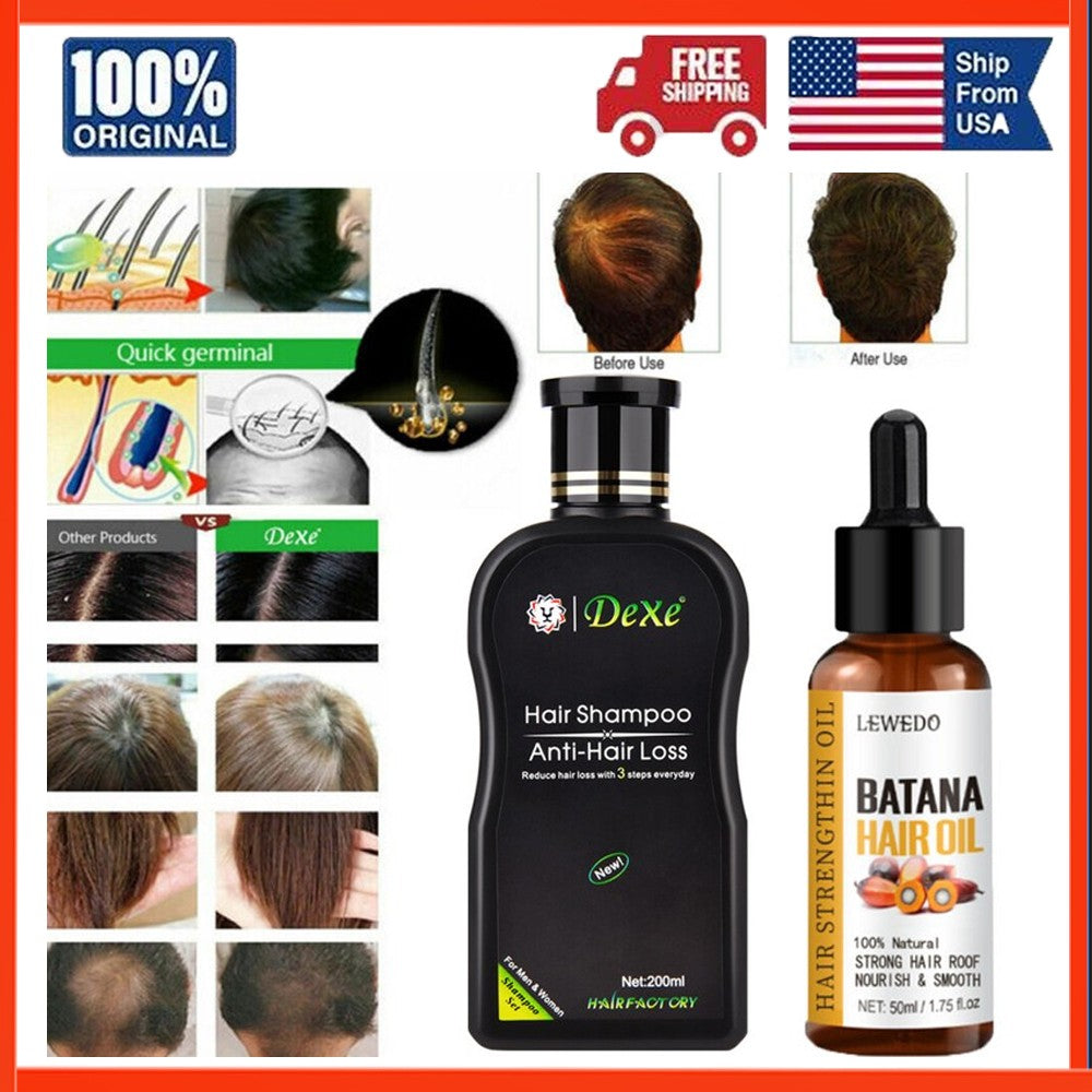 Anti-Hair Loss Shampoo for Men and Women | Dexe Herbal Hair Growth Formula 200ml