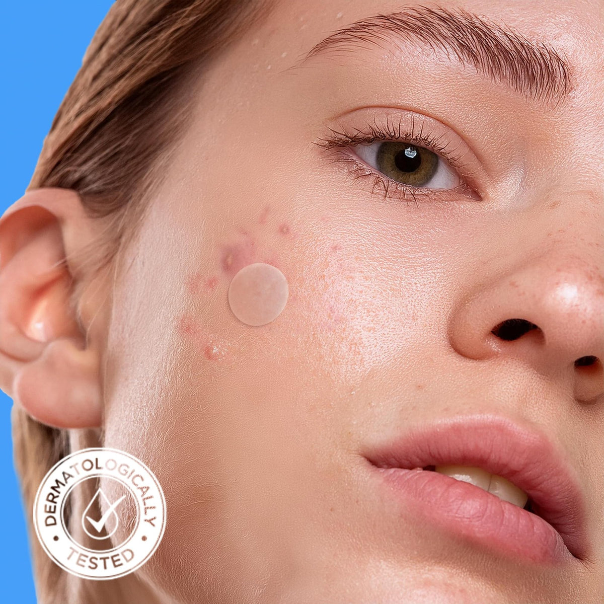 Hydrocolloid Acne Pimple Patches - 40 Count, Clear, All-Natural & Vegan