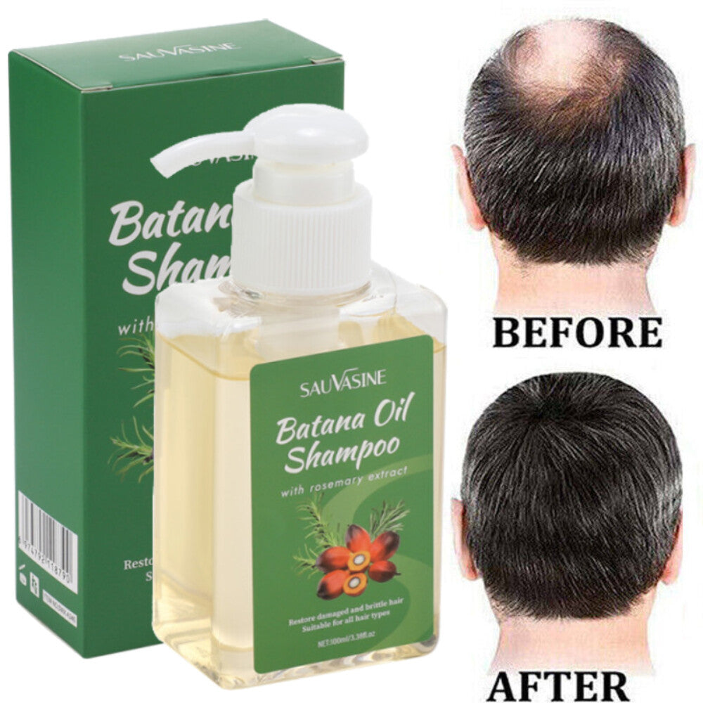 Anti-Hair Loss Rosemary Shampoo with 100ml - Nourishing Hair Growth